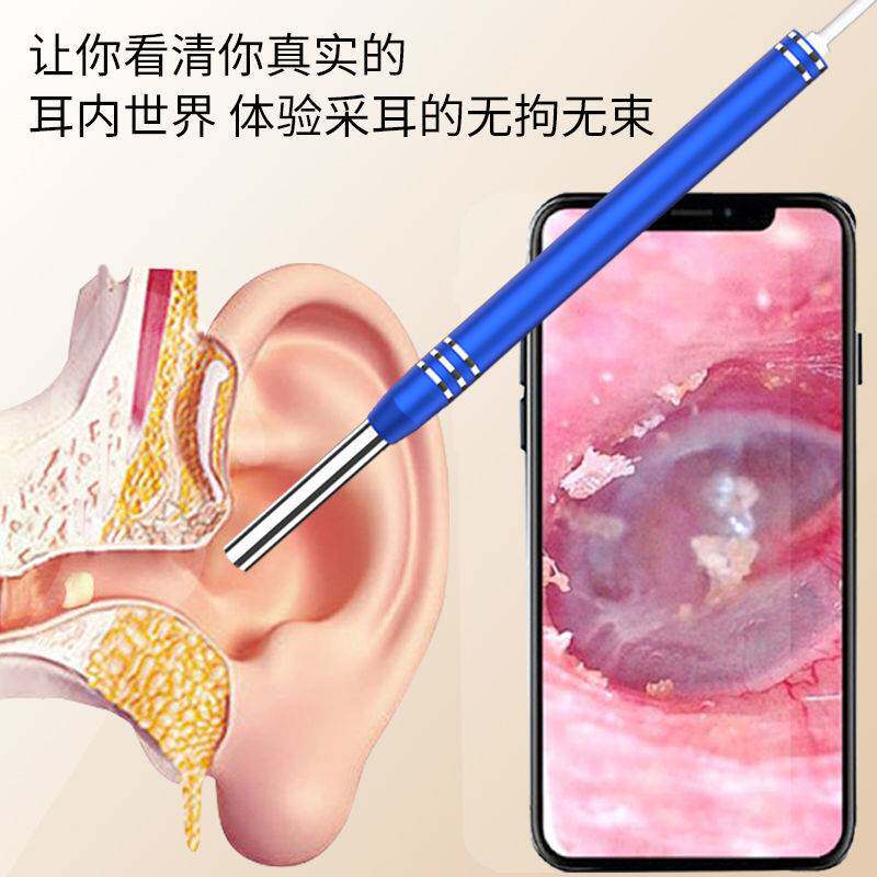 宝宝发光掏耳神器可视挖耳勺掏耳朵采耳工具儿童耳屎清洁器检耳镜