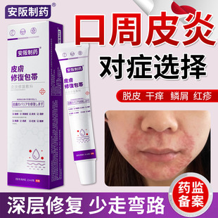 口周皮炎专嘴角干燥起皮用面部鼻子两侧脂溢性儿童唇周湿疹药膏ky