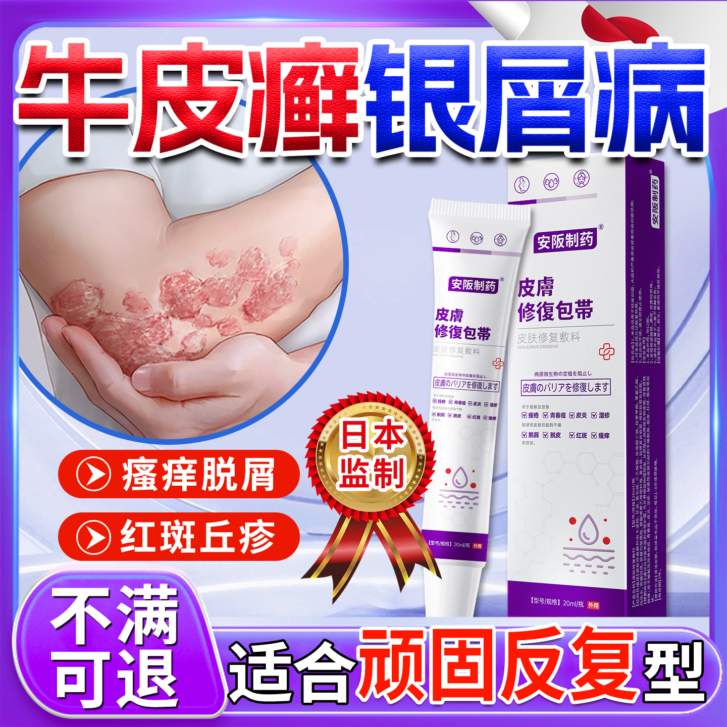 牛皮癣藓银屑病专皮肤瘙痒用药膏特红疹脱屑瘙痒效修复旗舰店KY