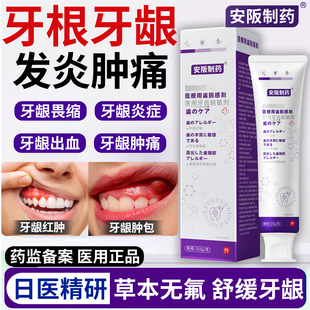 牙龈炎脓包肿痛牙根发炎牙周炎口腔牙龈萎缩消炎牙膏可搭漱口水sj
