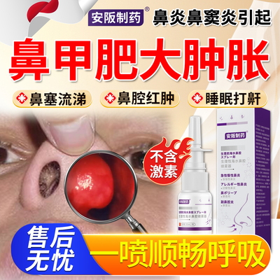 鼻甲肥大肿胀专消炎修复用特鼻炎鼻窦炎效鼻塞堵塞流涕喷雾剂KY