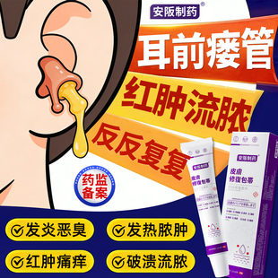 耳前瘘管药膏耳仓发炎流脓红肿瘙痒发臭味防水贴先天性清理工具KY