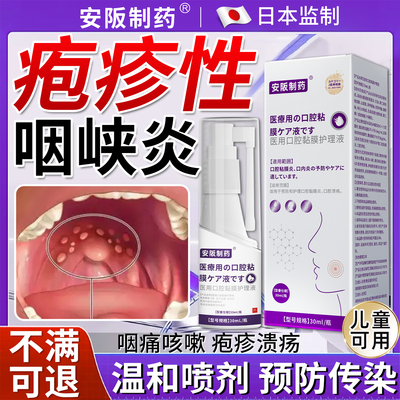 疱疹性咽峡炎儿童喷雾剂扁桃体发炎咽喉肿痛除咽炎慢性咽喉炎根KY