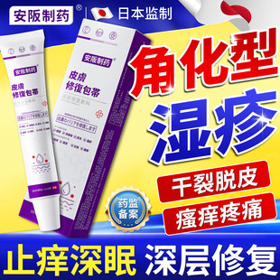 角化型湿疹手癣膏脱皮干裂真菌感染手指皲裂粗糙增厚药膏止痒KY