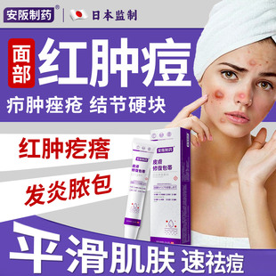 祛痘药膏治痤疮粉刺脸上下巴反复长痘疖肿结节起硬块红肿毛囊炎sj