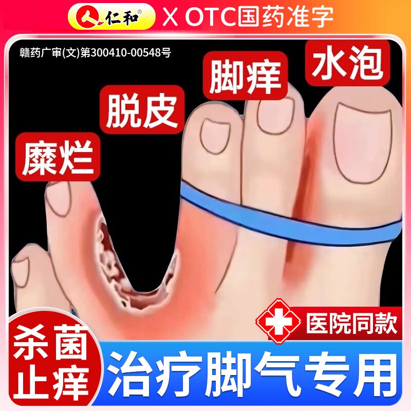 仁和治疗脚气专用药膏脚痒杀菌止痒脱皮去真菌感染水泡型烂脚丫