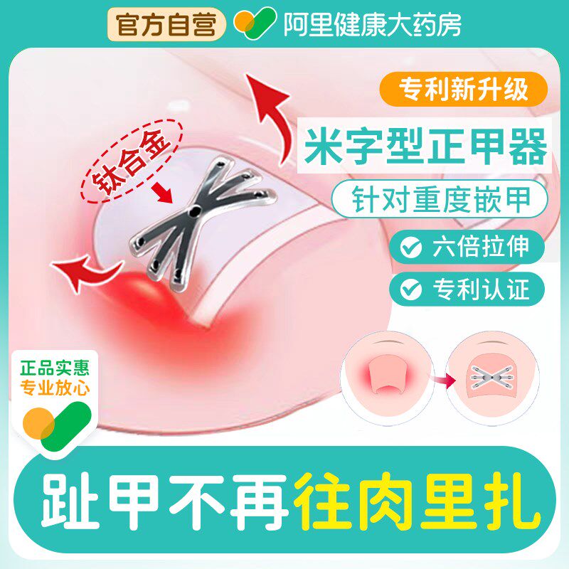 赤坂甲沟嵌甲炎h矫正器正甲贴指甲内嵌纠正贴脚趾指甲往肉里长专