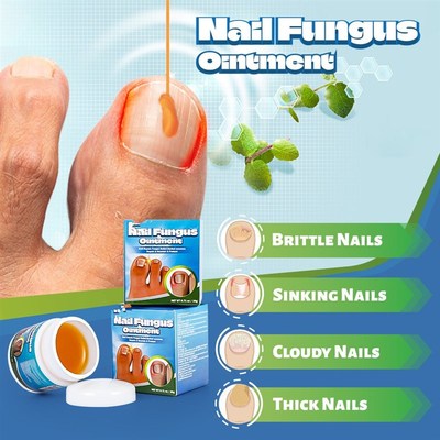 2pcs Foot Fungus Antifungal Cream Toe Bacteria Nail Fungus