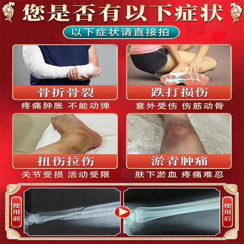骨折骨裂恢复药快速接骨续筋膏陈旧老伤跌打损伤活血化瘀德国马膏