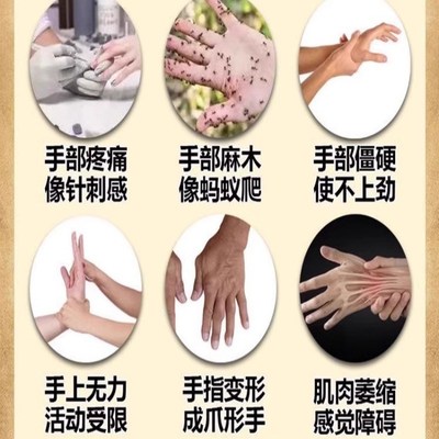 手神经受损肌肉萎缩康复器手腕三角软骨损伤僵硬发麻疼痛弯曲困难