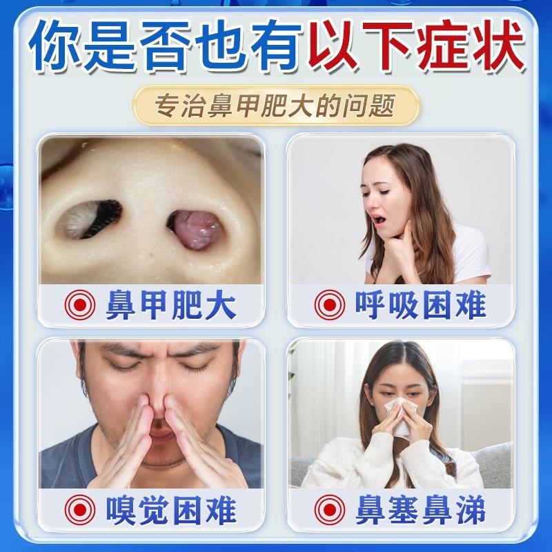 鼻甲肥大专用特效药消炎修复儿童鼻炎鼻塞鼻中隔偏曲消肿通鼻神器
