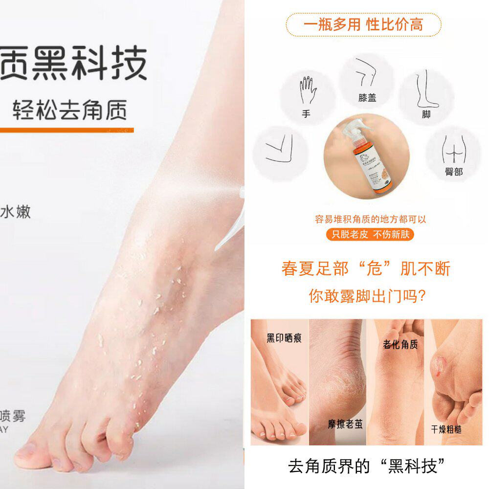 蓓斯去角质喷雾足部护理手肘膝盖