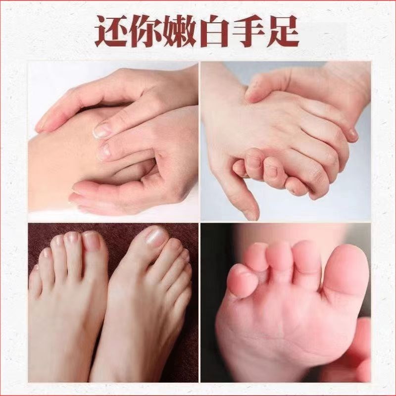 正品云南真菌王脚后跟起皮粗糙干裂起硬皮手开口干裂防裂膏