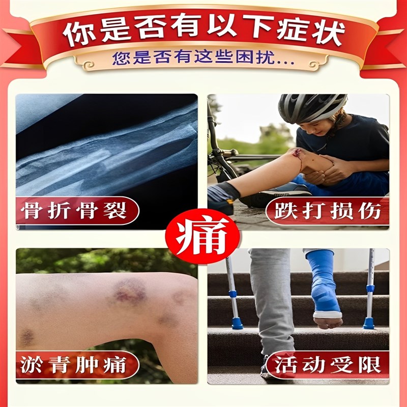 骨折骨裂恢复药快速接骨活血化瘀韧带拉伤伤筋动骨跌打损伤特效膏
