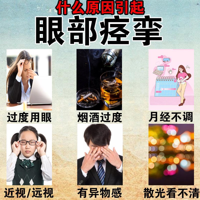 眼皮跳眼睑痉挛贴冶疗眼皮跳贴左右眼睛跳用眼过度的药眼跳专用贴