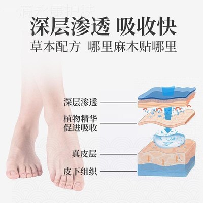 四肢手脚麻木专用穴位膏药贴缓解治手足指尖胳膊脚趾麻木酸胀神器