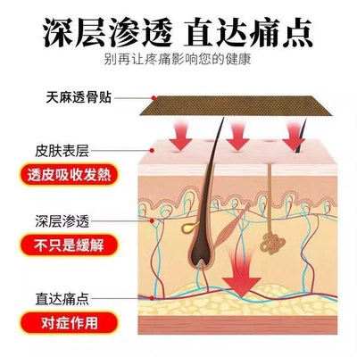 天麻透骨贴膏止痛腰椎膝盖颈椎包肩周肩膀手脚麻木风痛专用通经络