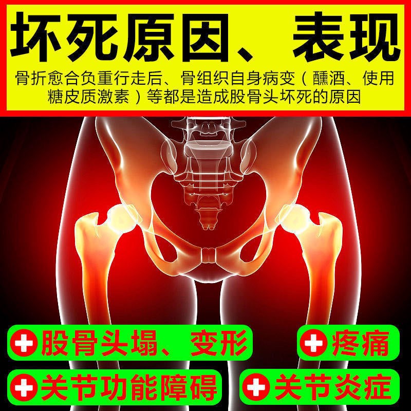 髋关节股骨头疼痛贴大腿屁股疼尾椎疼髋关节发炎疼痛跛行塌陷贴膏