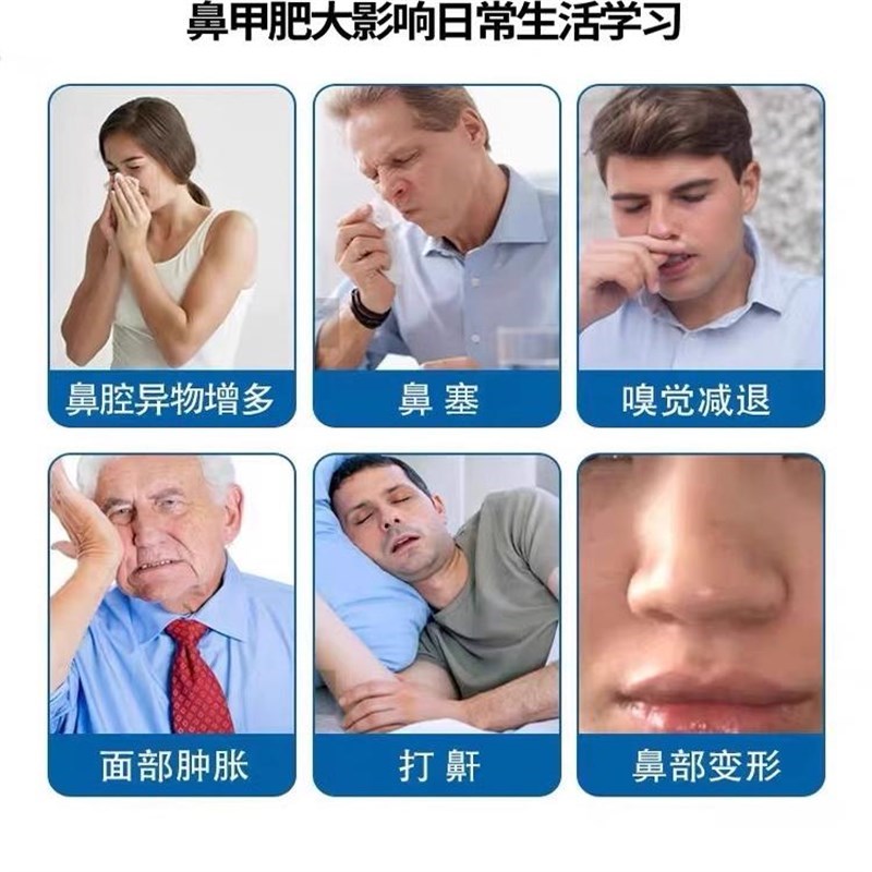 鼻甲肥大消炎修复鼻子发炎不通气息肉过敏性鼻窦炎特效专用药喷雾