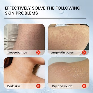 Chicken Skin Rough 3pcs Pore pilaris skin Spots Keratosis