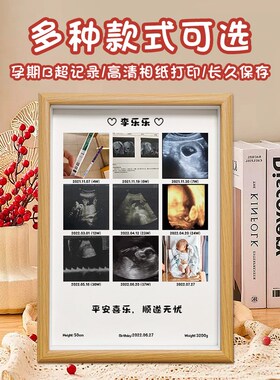 宝妈孕期B超相框定制 四维彩超照片婴儿出生满月百日周岁礼物纪念