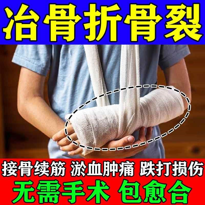 骨折骨裂恢复药膏快速接骨愈合活血化瘀伤筋动骨跌打损伤消肿止痛