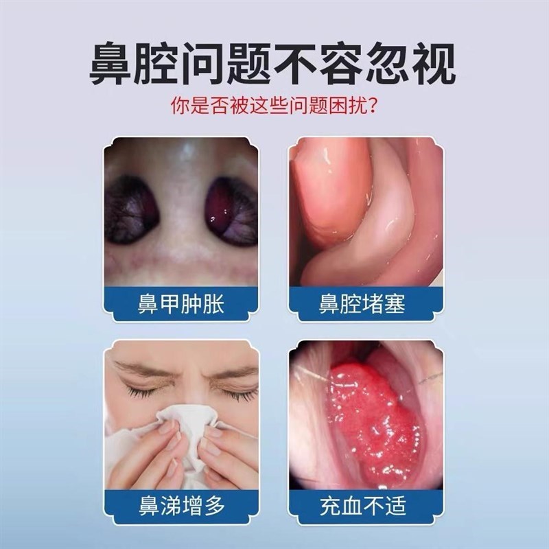 鼻甲肥大消炎修复鼻子发炎不通气息肉过敏性鼻窦炎特效专用药喷雾