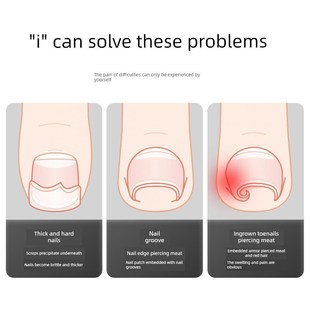 采购鹰嘴槽钳子,甲沟炎专用剪刀,修剪工具,钳,脚趾剪刀,特殊尖嘴