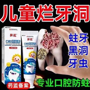 牙膏防蛀抗敏含氟儿童蛀牙专用龋齿修复牙膏去牙菌斑齿脱矿钙化YY