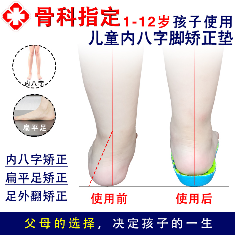儿童足外翻矫正鞋垫机能鞋X腿矫正垫宝宝内八字矫正器足弓纠正鞋