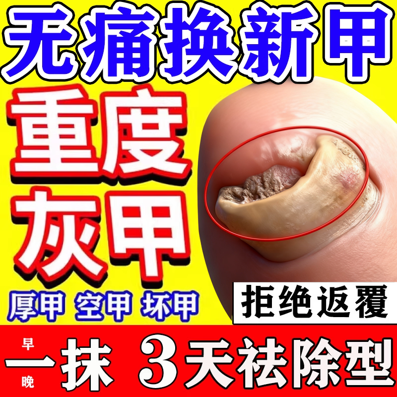 【金归】环吡酮胺乳膏1%*20g*1支/盒