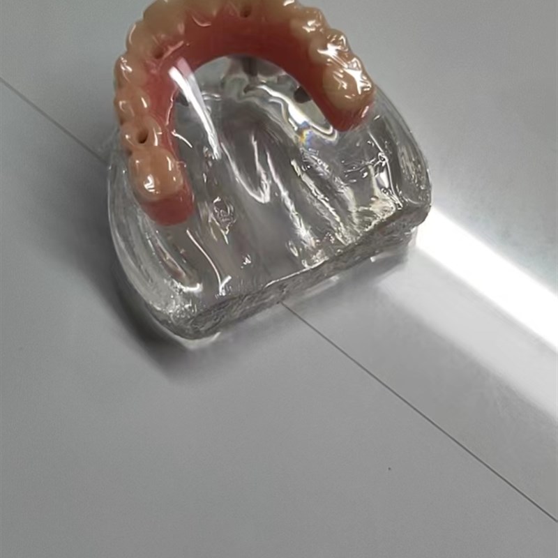 马龙连桥 义齿种植修复模型