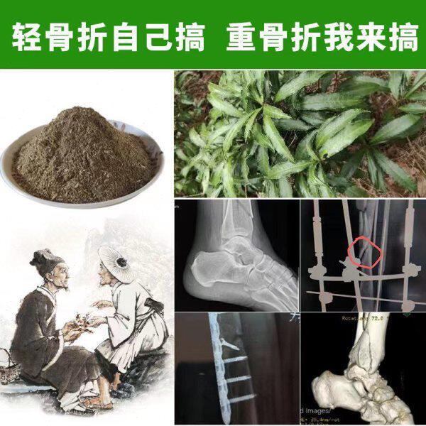 骨裂恢复接骨膏骨伤愈合压缩性陈旧跌打损伤脚裸扭伤跌打断续闪腰