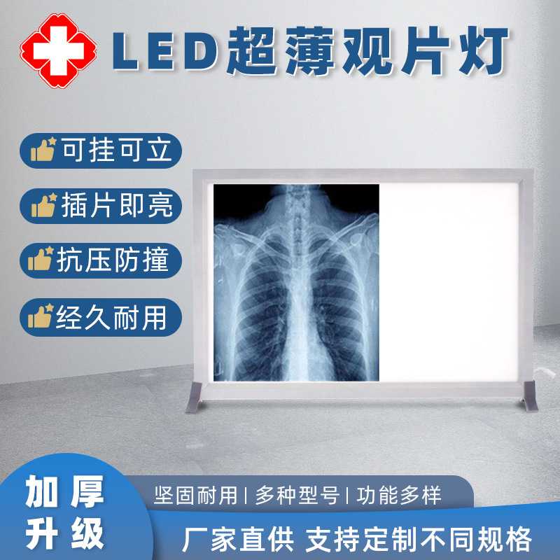 现货单双联LED观片灯片X光胶片观片灯 超薄阅片灯CT看片灯