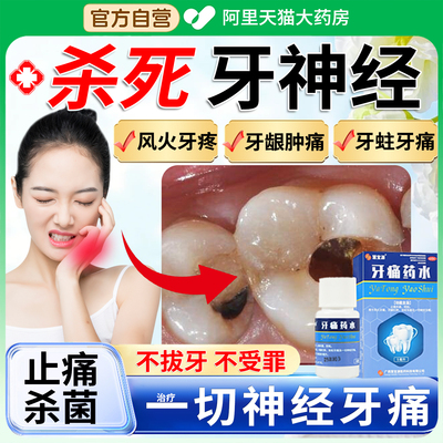 【慧宝源】牙痛药水5ml*1瓶/盒