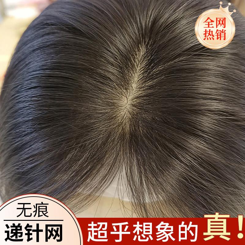 假发女头顶补发片双递针前额蕾丝全真发双递针真头皮轻薄透气无痕