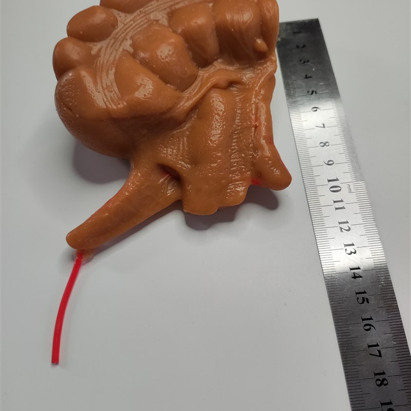 外科腹腔镜阑尾切除3D模型模块