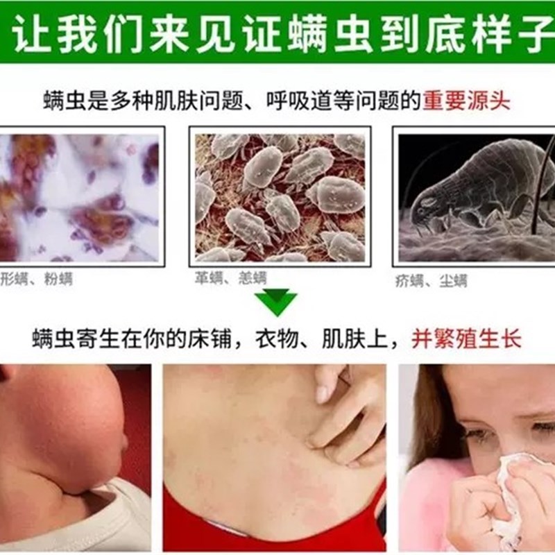 2瓶 二甲基丙烷羧酸酯溶液家居环境消毒剂杀疥螨虫尘螨除螨喷雾剂