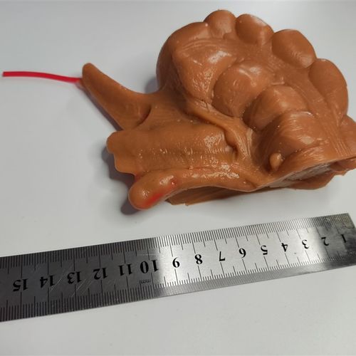 外科腹腔镜阑尾切除3D模型模块