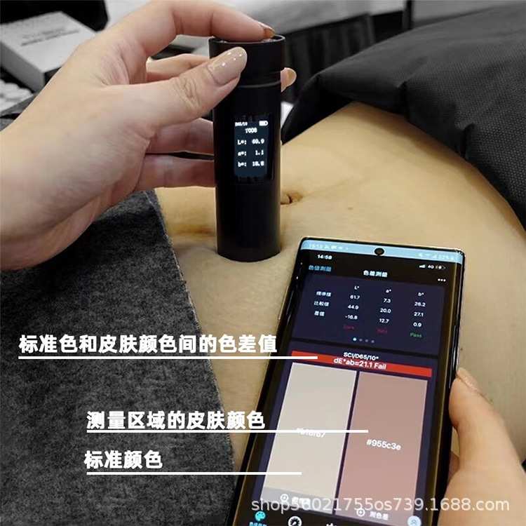 肤色重建术 皮肤测色仪 色差宝生长纹妊娠纹半遮盖术测肤仪