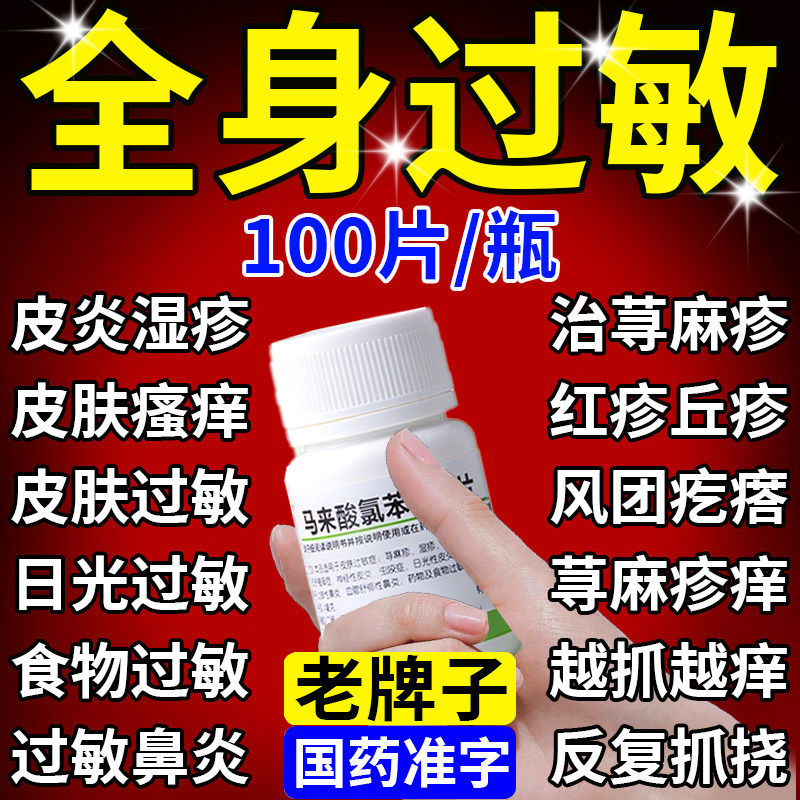皮肤瘙痒止痒扑尔敏片100片全身痒荨麻疹过敏药马来酸氯苯那敏片