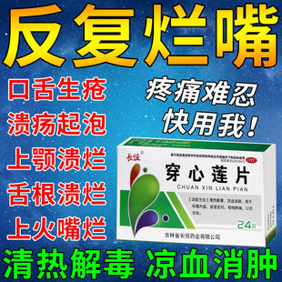 口腔溃疡专用药口舌生疮药嘴巴上火起泡舌头溃疡口疮中药穿心莲片
