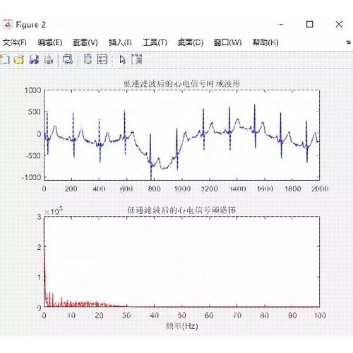 心电信号ECG去噪Matlab程序使用低通滤波和小波分解结合