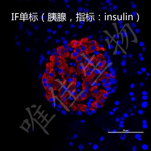 免疫组化(IHC)免疫荧光(IF) Tunel 凋亡 细胞实验图片量化分析