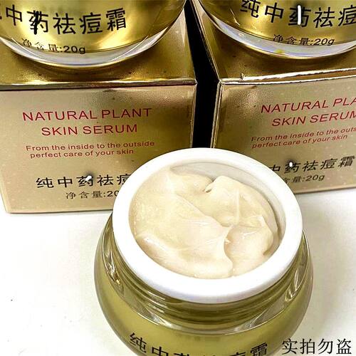 中草药祛痘膏 祛青春痘上火痘祛粉刺闭口痘痘 痤疮脓包 修护痘印