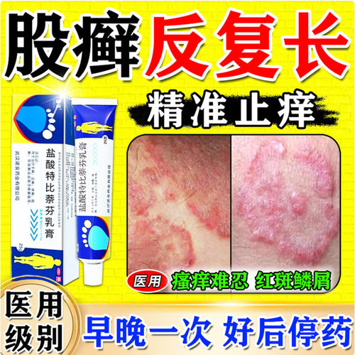 【白云山】盐酸特比萘芬乳膏1%*18g*1支/盒