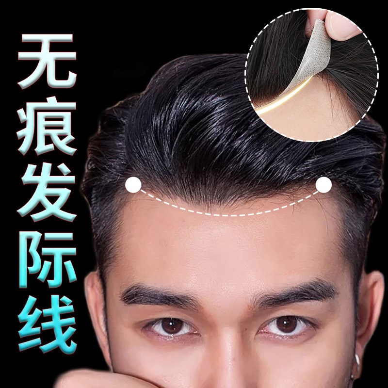 发际线贴前额补发片男士发片生物头皮补前额假刘海V针补发块背头