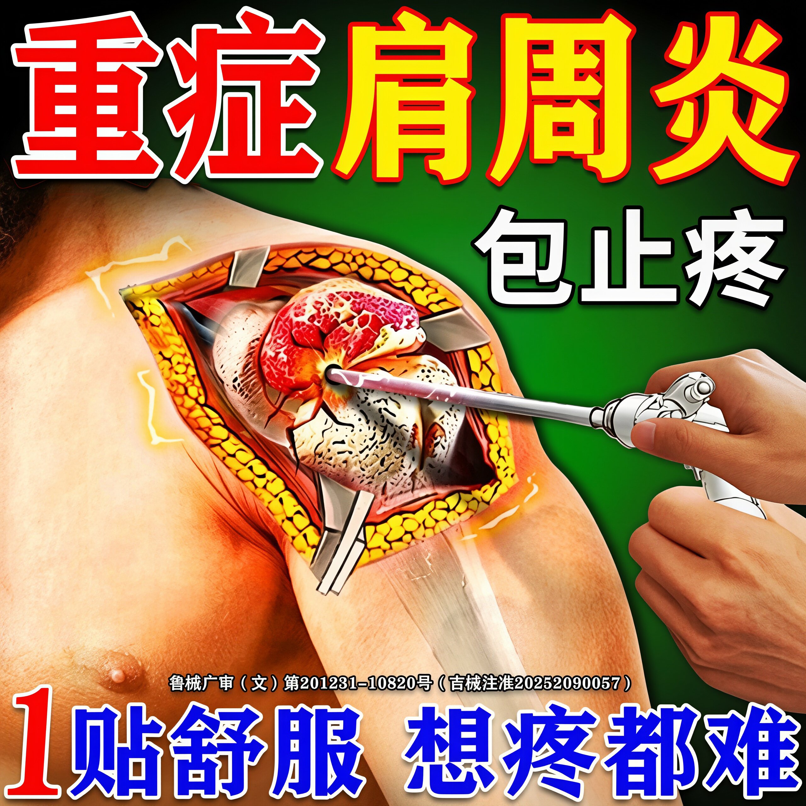 肩周炎专用贴膏】800%包断裉
