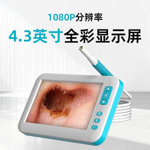 可视化采耳仪器一体化技师专用耳镜挖耳勺高清