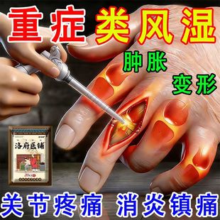 专治类风湿性关节炎痛风祛风除湿手指骨关节炎变形肿大非专用膏药